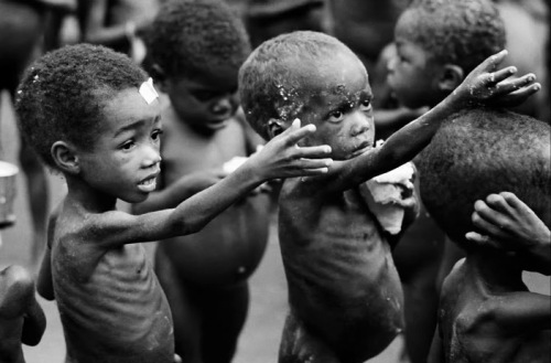 starving-children-1